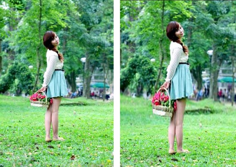 Before & after sau khi kéo dài chân