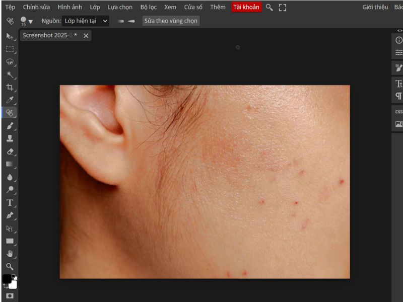 Cách xóa mụn trong Photoshop Online nhanh