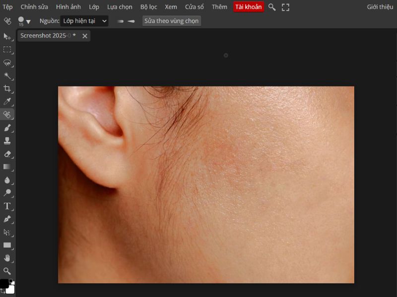 Lặp lại thao tác nếu vùng mụn chưa sạch